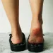 Acupoint Massage Slippers Sandal Feet Chinese Acupressure Therapy Rotating Foot Massager Shoes Unisex 260518_vogvips.com
