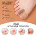 Silicone Bunion Corrector & Toe Separator – Skin-Tone Adjustable Splint For Hallux Valgus & Overlapping Toes (S/L Sizes, Unisex)_vogvips.com