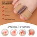 Silicone Toe Separator – Dual-Hole Bunion Corrector For Overlapping Toes & Hallux Valgus (Skin Tone, S/L Sizes, All-Season Comfort)_vogvips.com