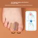 Silicone Bunion Corrector & Toe Separator – Skin-Tone Adjustable Splint For Hallux Valgus & Overlapping Toes (S/L Sizes, Unisex)_vogvips.com