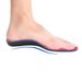 EVA flat foot correction insole for inward turned feet, outward turned flat feet, XO shaped legs correction for high arch pads for men and women_vogvips.com