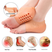 Invisible Height Boost Insoles – 2.5cm/3.5cm SEBS Heel Pads For Sneakers & Boots (Unisex, Skin/White, No-Slip Design)_vogvips.com