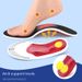 Breathable & Shock-Absorbing Orthotic Insoles For Men & Women – Arch Support, Lightweight & Durable, Universal Fit For All Shoes (Black Mesh)_vogvips.com